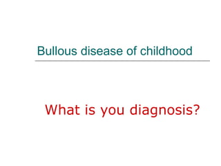 Bullous disease of childhood What is you diagnosis? 