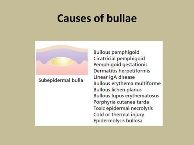 Bullous diseases | PPT