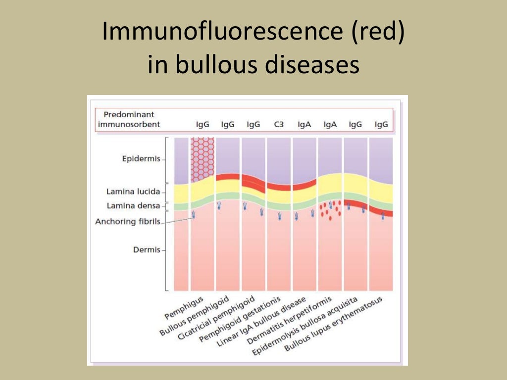 Bullous diseases