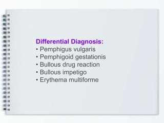 Differential Diagnosis:
• Pemphigus vulgaris
• Pemphigoid gestationis
• Bullous drug reaction
• Bullous impetigo
• Erythema multiforme
 