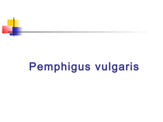 Pemphigus vulgaris
 