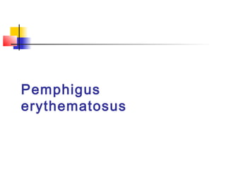 Pemphigus
erythematosus
 