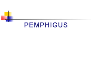 PEMPHIGUS
 