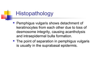 Histopathology
 Pemphigus vulgaris shows detachment of
keratinocytes from each other due to loss of
desmosome integrity, causing acantholysis
and intraepidermal bulla formation.
 The point of separation in pemphigus vulgaris
is usually in the suprabasal epidermis.  
 