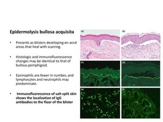 Epidermolysis bullosa acquisita
• Presents as blisters developing on acral
areas that heal with scarring.
• Histologic and immunofluorescence
changes may be identical to that of
bullous pemphigoid.
• Eosinophils are fewer in number, and
lymphocytes and neutrophils may
predominate.
• Immunofluorescence of salt-split skin
shows the localization of IgG
antibodies to the floor of the blister
 