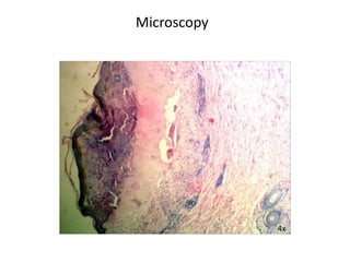 Microscopy
4x
 