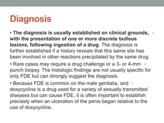 Diagnosis
•
• The diagnosis is usually established on clinical grounds,
with the presentation of one or more discrete bullous
lesions, following ingestion of a drug. The diagnosis is
further established if a history reveals that this same site has
been involved in other reactions precipitated by the same drug.
•
• Rare cases may require a drug challenge or a 3- or 4-mm
punch biopsy. The histologic findings are not usually specific for
only FDE but can strongly suggest the diagnosis.
•
• Because FDE is common on the male genitalia, and
doxycycline is a drug used for a variety of sexually transmitted
diseases but can cause FDE, it is often important to establish
precisely when an ulceration of the penis began relative to the
use of doxycycline.
 