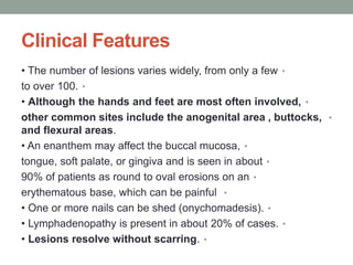 Clinical Features
•
• The number of lesions varies widely, from only a few
•
to over 100.
•
• Although the hands and feet are most often involved,
•
other common sites include the anogenital area , buttocks,
and flexural areas.
•
• An enanthem may affect the buccal mucosa,
•
tongue, soft palate, or gingiva and is seen in about
•
90% of patients as round to oval erosions on an
•
erythematous base, which can be painful
•
• One or more nails can be shed (onychomadesis).
•
• Lymphadenopathy is present in about 20% of cases.
•
• Lesions resolve without scarring.
 
