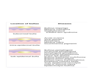 Comprehensive Overview of Bullous Skin Diseases: Immunobullous and ...