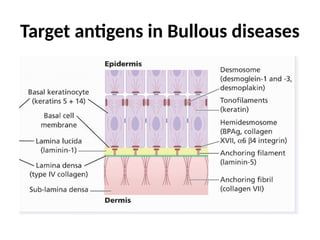 Bullous Process Comprehensive Overview of Bullous Skin Diseases: Immunobullous and ...