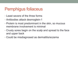 Pemphigus foliaceus
• Least severe of the three forms
• Antibodies attack desmoglein-1
• Protein is most predominant in the skin, so mucous
membrane involvement is minimal
• Crusty sores begin on the scalp and spread to the face
and upper back
• Could be misdiagnosed as dermatitis/eczema
 