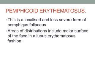 PEMPHIGOID ERYTHEMATOSUS.
• This is a localised and less severe form of
pemphigus foliaceus.
• Areas of distributions include malar surface
of the face in a lupus erythematosus
fashion.
 