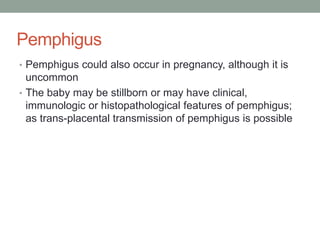 Pemphigus
• Pemphigus could also occur in pregnancy, although it is
uncommon
• The baby may be stillborn or may have clinical,
immunologic or histopathological features of pemphigus;
as trans-placental transmission of pemphigus is possible
 