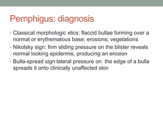 Pemphigus: diagnosis
• Classical morphologic xtics: flaccid bullae forming over a
normal or erythematous base; erosions; vegetations
• Nikolsky sign: firm sliding pressure on the blister reveals
normal looking epidermis, producing an erosion
• Bulla-spread sign:lateral pressure on the edge of a bulla
spreads it onto clinically unaffected skin
 