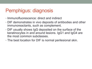 Pemphigus: diagnosis
• Immunofluorescence: direct and indirect
• DIF demonstrates in vivo deposits of antibodies and other
immunoreactants, such as complement.
• DIF usually shows IgG deposited on the surface of the
keratinocytes in and around lesions. IgG1 and IgG4 are
the most common subclasses.
• The best location for DIF is normal perilesional skin.
 