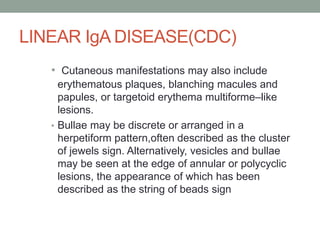 LINEAR IgA DISEASE(CDC)
• Cutaneous manifestations may also include
erythematous plaques, blanching macules and
papules, or targetoid erythema multiforme–like
lesions.
• Bullae may be discrete or arranged in a
herpetiform pattern,often described as the cluster
of jewels sign. Alternatively, vesicles and bullae
may be seen at the edge of annular or polycyclic
lesions, the appearance of which has been
described as the string of beads sign
 
