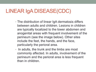 LINEAR IgA DISEASE(CDC)
• The distribution of linear IgA dermatosis differs
between adults and children. Lesions in children
are typically localized to the lower abdomen and
anogenital areas with frequent involvement of the
perineum (see the image below). Other sites
include the feet, the hands, and the face,
particularly the perioral area.
• In adults, the trunk and the limbs are most
commonly affected. In adults, involvement of the
perineum and the perioral area is less frequent
than in children.
 
