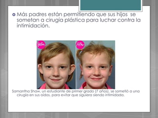  Más  padres están permitiendo que sus hijos se
  sometan a cirugía plástica para luchar contra la
  intimidación.




Samantha Shaw, un estudiante de primer grado (7 años), se sometió a una
  cirugía en sus oídos. para evitar que siguiera siendo intimidada.
 
