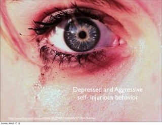 Depressed and Aggressive
                                                        self- injurious behavior

       http://www.ﬂickr.com/photos/40645538@N00/3366636571/">Pink Sherbet
Sunday, March 17, 13
 