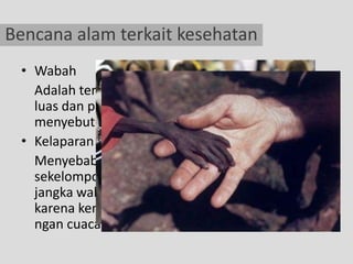Bencana alam terkait kesehatan
 • Wabah
   Adalah tersebarnya penyakit pada daerah yang
   luas dan pada banyak orang, maupun untuk
   menyebut penyakit yang menyebar tersebut.
 • Kelaparan
   Menyebabkan kekurangan gizi yang dialami
   sekelompok orang dalam jumlah besar untuk
   jangka waktu yang relatif lama, biasanya
   karena kemiskinan, konflik politik, maupun kekeri
   ngan cuaca.
 