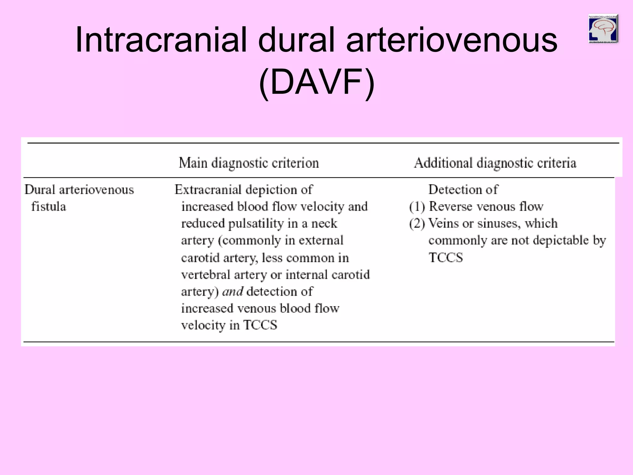 Intracranial dural arteriovenous
(DAVF)
 