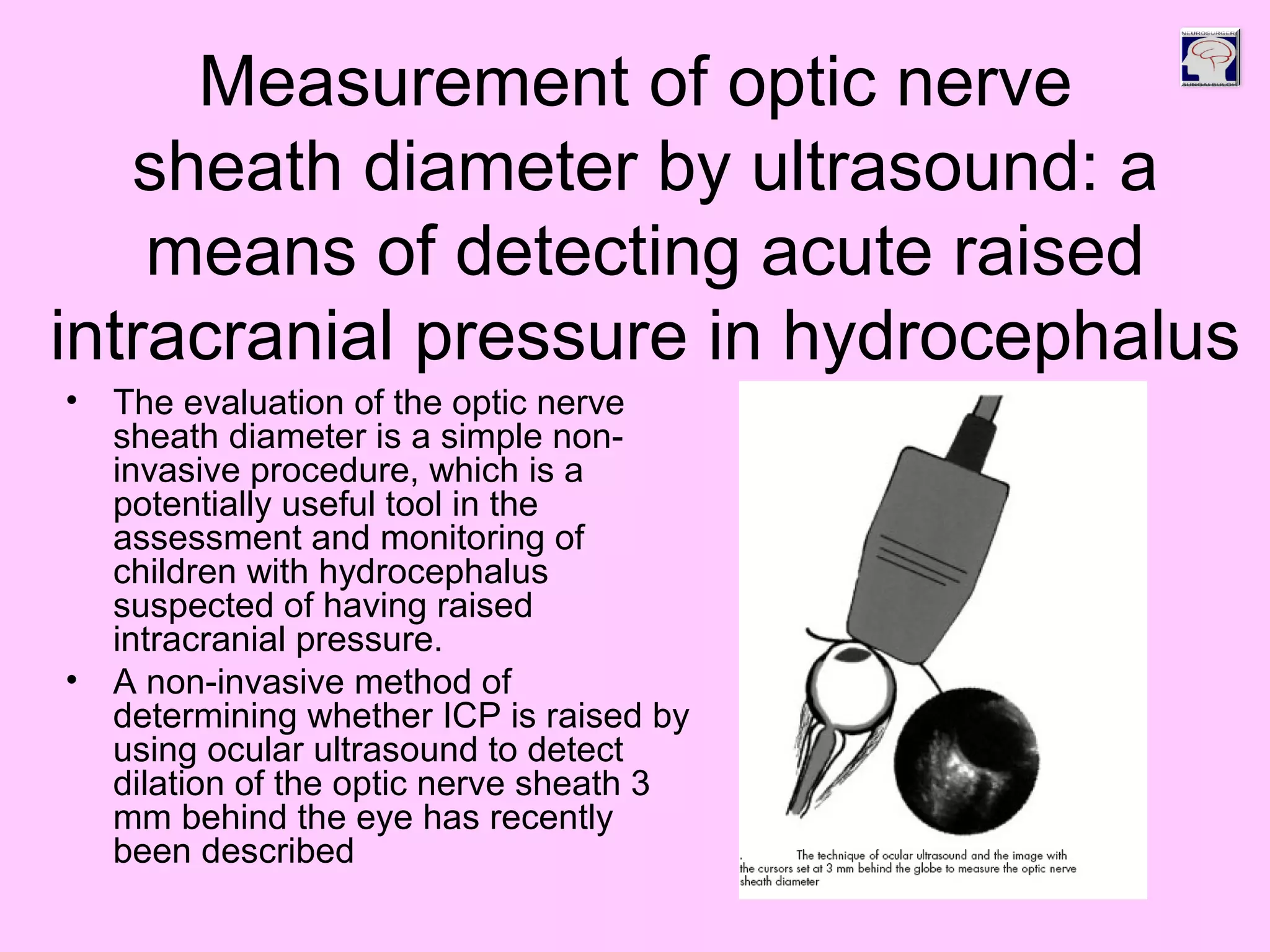 Measurement of optic nerve
sheath diameter by ultrasound: a
means of detecting acute raised
intracranial pressure in hydrocephalus
• The evaluation of the optic nerve
sheath diameter is a simple non-
invasive procedure, which is a
potentially useful tool in the
assessment and monitoring of
children with hydrocephalus
suspected of having raised
intracranial pressure.
• A non-invasive method of
determining whether ICP is raised by
using ocular ultrasound to detect
dilation of the optic nerve sheath 3
mm behind the eye has recently
been described
 
