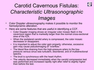 Carotid Cavernous Fistulas:
Characteristic Ultrasonographic
Images
• Color Doppler ultrasonography makes it possible to monitor the
hemodynamic alteration.
• Here are some features that are useful in identifying a CCF.
– Color Doppler imaging shows an irregular color mosaic flash in the
cavernous region that is markedly larger than the normal cross-sectional
area of the ICA.
– When the ipsilateral carotid artery is compressed, the color mosaic
decreases or disappears.
– It is important to adjust the color gain properly; otherwise, excessive
gain may cause pseudoimaging of “overflow.”
– The blood flow draining from the high-pressure artery to the low-
pressure venous sinus was turbulent, disordered, and of multidirectional
spectra.
– The bruit is synchronous with the heart rhythm.
– The velocity decreased immediately when the carotid compression test
was performed and increased rapidly right after relief to slightly higher
than before the test.
 