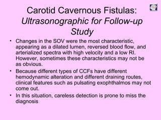• Changes in the SOV were the most characteristic,
appearing as a dilated lumen, reversed blood flow, and
arterialized spectra with high velocity and a low RI.
However, sometimes these characteristics may not be
as obvious.
• Because different types of CCFs have different
hemodynamic alteration and different draining routes,
clinical features such as pulsating exophthalmos may not
come out.
• In this situation, careless detection is prone to miss the
diagnosis
Carotid Cavernous Fistulas:
Ultrasonographic for Follow-up
Study
 
