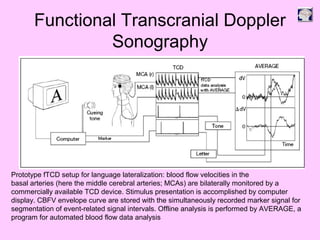 Functional Transcranial Doppler
Sonography
Prototype fTCD setup for language lateralization: blood flow velocities in the
basal arteries (here the middle cerebral arteries; MCAs) are bilaterally monitored by a
commercially available TCD device. Stimulus presentation is accomplished by computer
display. CBFV envelope curve are stored with the simultaneously recorded marker signal for
segmentation of event-related signal intervals. Offline analysis is performed by AVERAGE, a
program for automated blood flow data analysis
 