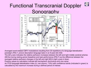 Functional Transcranial Doppler
Sonography
Averaged event-related CBFV modulations resulting from 30 repetitions of a language lateralization
paradigm (PDLT; picture description language task) in an 8-year-old child.
The left y-axis indicates the relative perfusion increases between the left and right middle cerebral arteries
(MCAs) during resting period (baseline) and task performance (PDLT) as the difference between the
averaged relative perfusion changes in the left and right MCA (right y-axis in blue).
Positive values by calculation indicate left hemispheric dominance and vice versa.
An fTCD language lateralization index (LI; red column; 7.8%) with confidence bands (indicated in green) is
calculated by the maximum increase during a defined period of interest
 