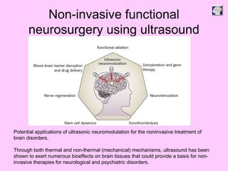Non-invasive functional
neurosurgery using ultrasound
Potential applications of ultrasonic neuromodulation for the noninvasive treatment of
brain disorders.
Through both thermal and non-thermal (mechanical) mechanisms, ultrasound has been
shown to exert numerous bioeffects on brain tissues that could provide a basis for non-
invasive therapies for neurological and psychiatric disorders.
 