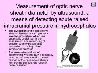 Measurement of optic nerve
sheath diameter by ultrasound: a
means of detecting acute raised
intracranial pressure in hydrocephalus
• The evaluation of the optic nerve
sheath diameter is a simple non-
invasive procedure, which is a
potentially useful tool in the
assessment and monitoring of
children with hydrocephalus
suspected of having raised
intracranial pressure.
• A non-invasive method of
determining whether ICP is raised by
using ocular ultrasound to detect
dilation of the optic nerve sheath 3
mm behind the eye has recently
been described
 