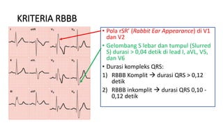 PENGERTIAN DAN KONSEP BUNDLE BRANCH BLOCK | PDF