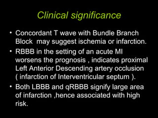Clinical significance
• Concordant T wave with Bundle Branch
Block may suggest ischemia or infarction.
• RBBB in the setting of an acute MI
worsens the prognosis , indicates proximal
Left Anterior Descending artery occlusion
( infarction of Interventricular septum ).
• Both LBBB and qRBBB signify large area
of infarction ,hence associated with high
risk.
 