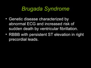 Brugada Syndrome
• Genetic disease characterized by
abnormal ECG and increased risk of
sudden death by ventricular fibrillation.
• RBBB with persistent ST elevation in right
precordial leads.
 