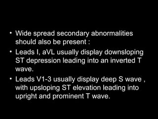 • Wide spread secondary abnormalities
should also be present :
• Leads I, aVL usually display downsloping
ST depression leading into an inverted T
wave.
• Leads V1-3 usually display deep S wave ,
with upsloping ST elevation leading into
upright and prominent T wave.
 