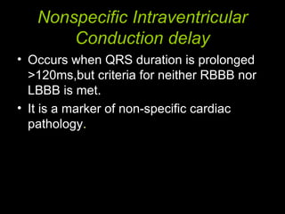 Nonspecific Intraventricular
Conduction delay
• Occurs when QRS duration is prolonged
>120ms,but criteria for neither RBBB nor
LBBB is met.
• It is a marker of non-specific cardiac
pathology.
 