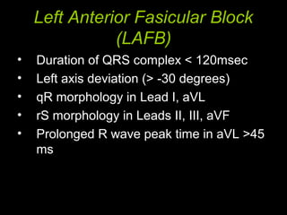 Left Anterior Fasicular Block
(LAFB)
• Duration of QRS complex < 120msec
• Left axis deviation (> -30 degrees)
• qR morphology in Lead I, aVL
• rS morphology in Leads II, III, aVF
• Prolonged R wave peak time in aVL >45
ms
 