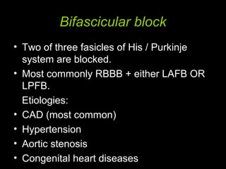 Bifascicular block
• Two of three fasicles of His / Purkinje
system are blocked.
• Most commonly RBBB + either LAFB OR
LPFB.
Etiologies:
• CAD (most common)
• Hypertension
• Aortic stenosis
• Congenital heart diseases
 