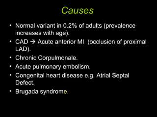 Causes
• Normal variant in 0.2% of adults (prevalence
increases with age).
• CAD  Acute anterior MI (occlusion of proximal
LAD).
• Chronic Corpulmonale.
• Acute pulmonary embolism.
• Congenital heart disease e.g. Atrial Septal
Defect.
• Brugada syndrome.
 