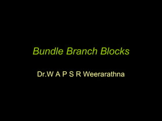 Bundle Branch Blocks

Dr.W A P S R Weerarathna
 
