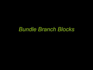 Bundle Branch Blocks 
