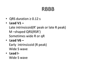 RBBB
• QRS duration ≥ 0.12 s
• Lead V1 –
Late intrinsicoid(R’ peak or late R peak)
M –shaped QRS(RSR’)
Sometimes wide R or qR
• Lead V6 –
Early intrinsicoid (R peak)
Wide S wave
• Lead I-
Wide S wave
 