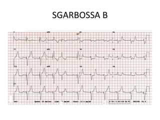 SGARBOSSA B
 