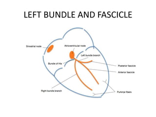 LEFT BUNDLE AND FASCICLE
 