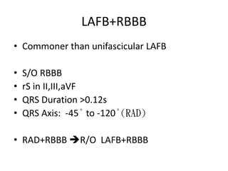 LAFB+RBBB
• Commoner than unifascicular LAFB
• S/O RBBB
• rS in II,III,aVF
• QRS Duration >0.12s
• QRS Axis: -45° to -120°(RAD)
• RAD+RBBB R/O LAFB+RBBB
 