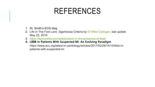 REFERENCES
1. Dr. Smith’s ECG blog
2. Life In The Fast Lane ,Sgarbossa Criteria by Dr Mike Cadogan, last update
May 22, 2019
3. https://epmonthly.com/article/stemi-in-the-presence-of-lbbb/
4. LBBB in Patients With Suspected MI: An Evolving Paradigm
https://www.acc.org/latest-in-cardiology/articles/2017/02/28/14/10/lbbb-in-
patients-with-suspected-mi
 