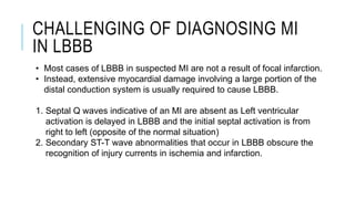 CHALLENGING OF DIAGNOSING MI
IN LBBB
• Most cases of LBBB in suspected MI are not a result of focal infarction.
• Instead, extensive myocardial damage involving a large portion of the
distal conduction system is usually required to cause LBBB.
1. Septal Q waves indicative of an MI are absent as Left ventricular
activation is delayed in LBBB and the initial septal activation is from
right to left (opposite of the normal situation)
2. Secondary ST-T wave abnormalities that occur in LBBB obscure the
recognition of injury currents in ischemia and infarction.
 