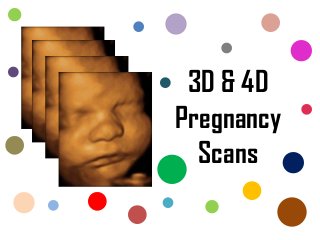 3D & 4D
Pregnancy
Scans
 