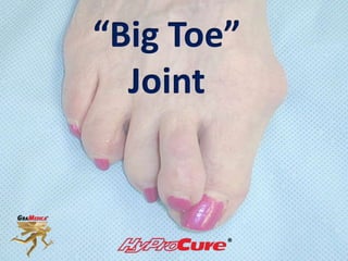 “Big Toe”
Joint
 